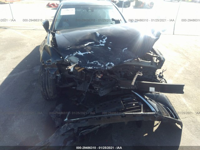 Photo 5 VIN: JTHBA1BLXHA004550 - LEXUS GS 