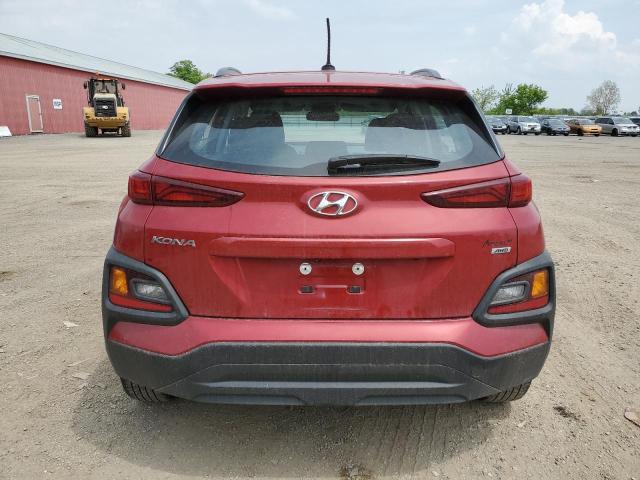 Photo 5 VIN: KM8K1CAAXJU124572 - HYUNDAI KONA 