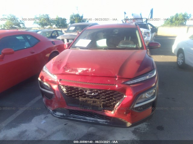 Photo 5 VIN: KM8K22AAXLU496116 - HYUNDAI KONA 