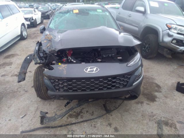 Photo 5 VIN: KM8K32AB7NU794017 - HYUNDAI KONA 