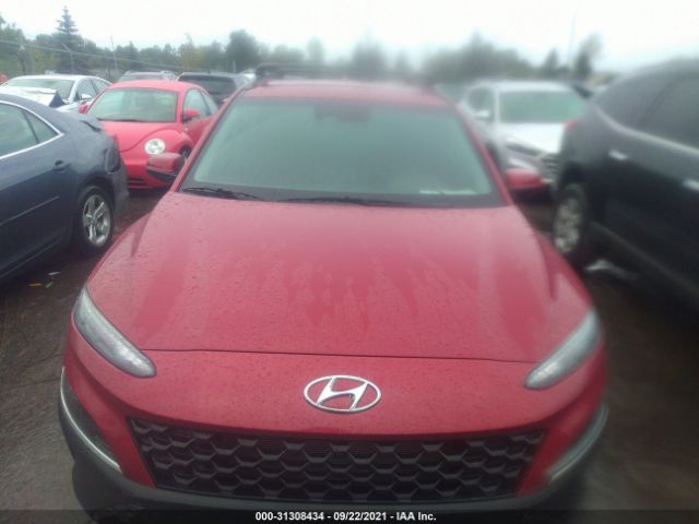 Photo 5 VIN: KM8K6CAB0NU773491 - HYUNDAI KONA 