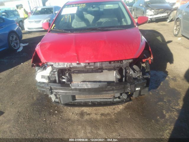 Photo 5 VIN: KMHCT4AE0HU320778 - HYUNDAI ACCENT 