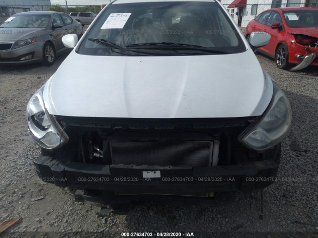 Photo 5 VIN: KMHCU5AE4CU037568 - HYUNDAI ACCENT 