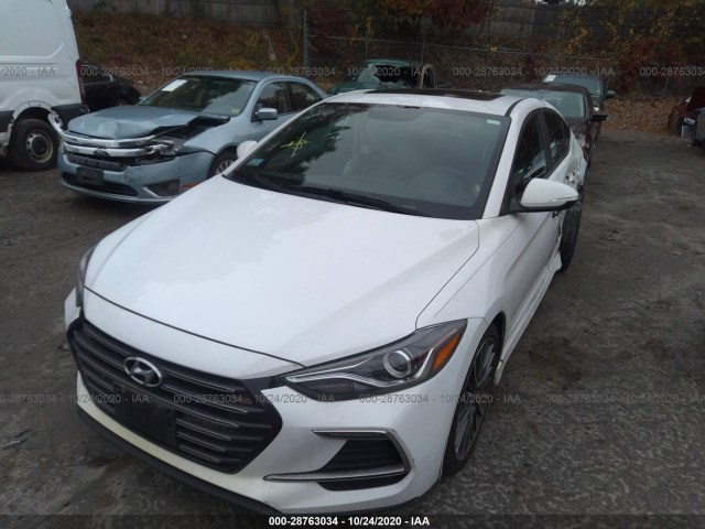 Photo 1 VIN: KMHD04LB0HU338519 - HYUNDAI ELANTRA 