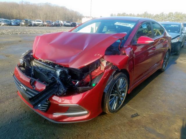 Photo 1 VIN: KMHD04LB0HU362657 - HYUNDAI ELANTRA SP 