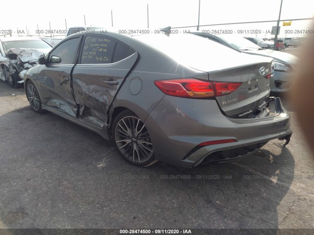 Photo 2 VIN: KMHD04LB2HU363616 - HYUNDAI ELANTRA 