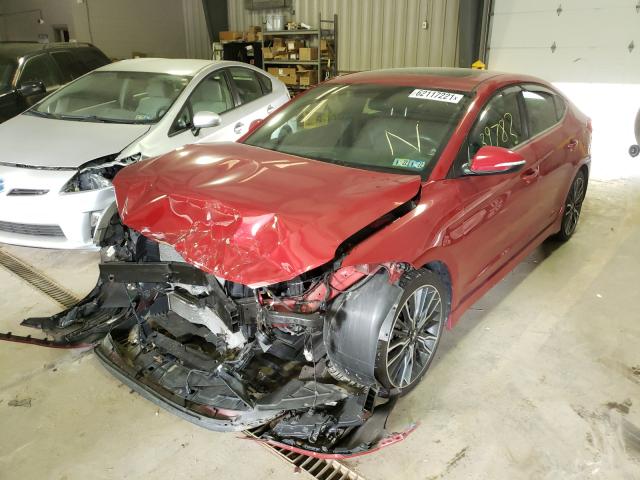 Photo 1 VIN: KMHD04LB2JU530160 - HYUNDAI ELANTRA SP 