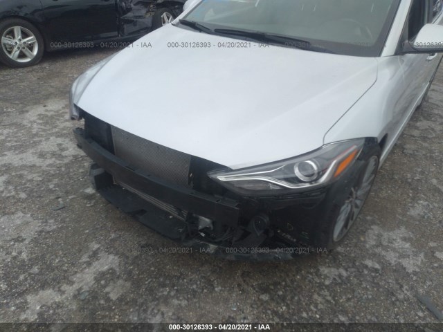 Photo 5 VIN: KMHD04LB3HU326218 - HYUNDAI ELANTRA 