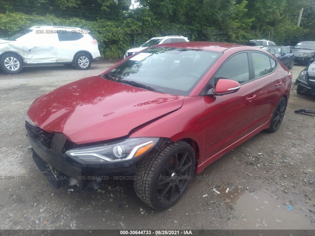 Photo 1 VIN: KMHD04LB7HU364681 - HYUNDAI ELANTRA 