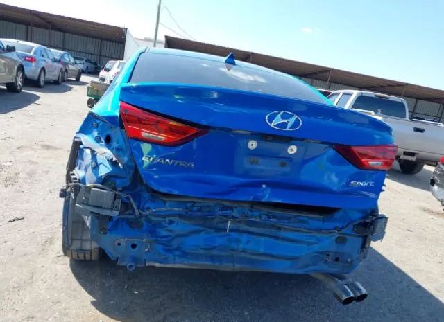 Photo 5 VIN: KMHD04LB8JU571666 - HYUNDAI ELANTRA 