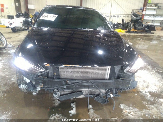 Photo 5 VIN: KMHD04LB9HU330287 - HYUNDAI ELANTRA 