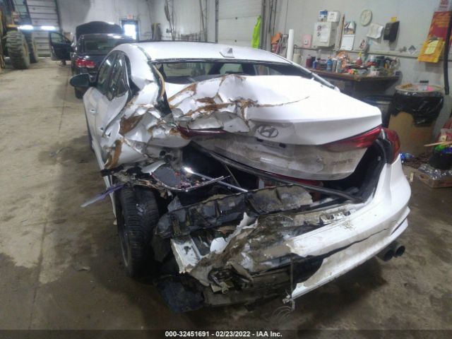 Photo 5 VIN: KMHD04LB9HU333285 - HYUNDAI ELANTRA 