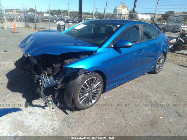 Photo 1 VIN: KMHD04LB9HU344061 - HYUNDAI ELANTRA 