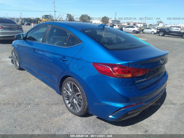 Photo 2 VIN: KMHD04LB9HU344061 - HYUNDAI ELANTRA 