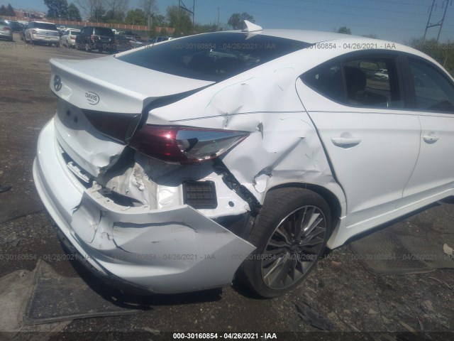 Photo 5 VIN: KMHD04LBXHU321548 - HYUNDAI ELANTRA 