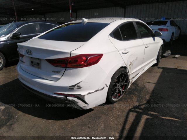 Photo 3 VIN: KMHD04LBXJU453215 - HYUNDAI ELANTRA 