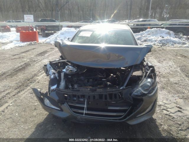 Photo 5 VIN: KMHD35LH7GU333351 - HYUNDAI ELANTRA GT 