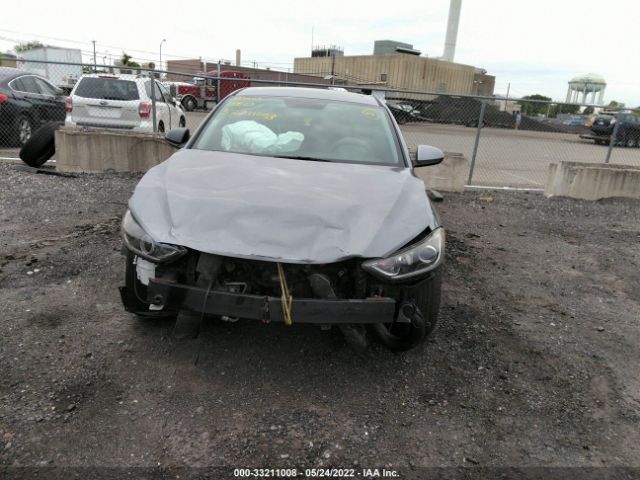 Photo 5 VIN: KMHD74LF6HU150425 - HYUNDAI ELANTRA 