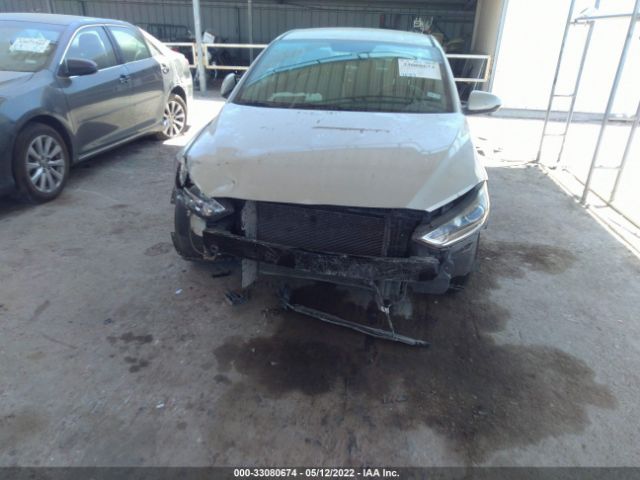 Photo 5 VIN: KMHD74LF8HU079373 - HYUNDAI ELANTRA 