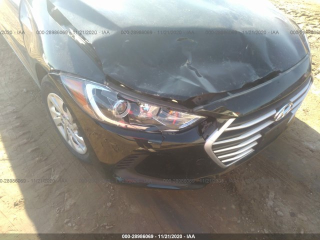 Photo 5 VIN: KMHD74LF9JU455486 - HYUNDAI ELANTRA 