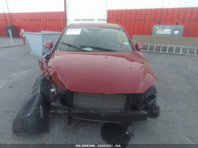 Photo 5 VIN: KMHD84LF1HU222547 - HYUNDAI ELANTRA 