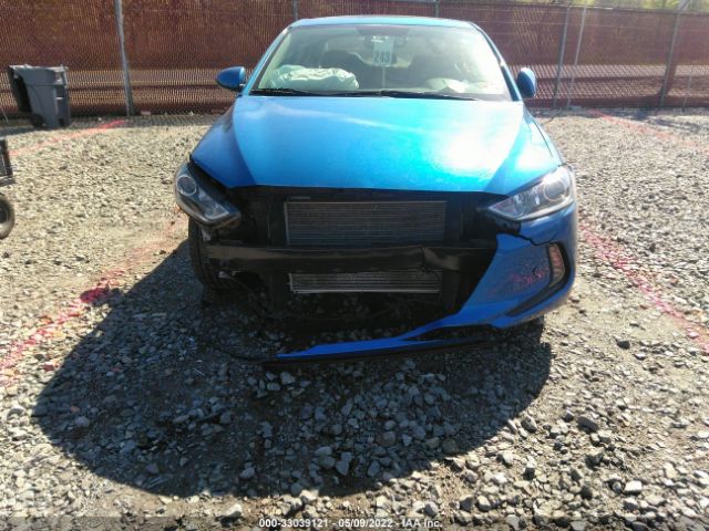 Photo 5 VIN: KMHD84LF3HU300987 - HYUNDAI ELANTRA 