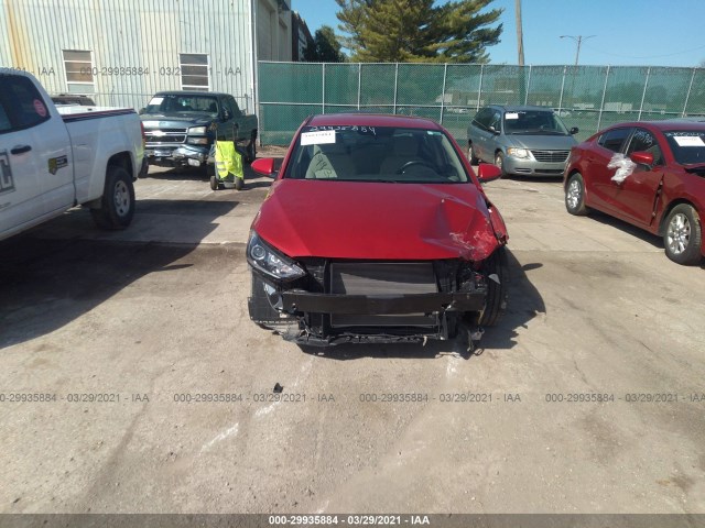 Photo 5 VIN: KMHD84LF3JU477738 - HYUNDAI ELANTRA 