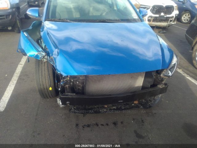 Photo 5 VIN: KMHD84LF7HU282543 - HYUNDAI ELANTRA 