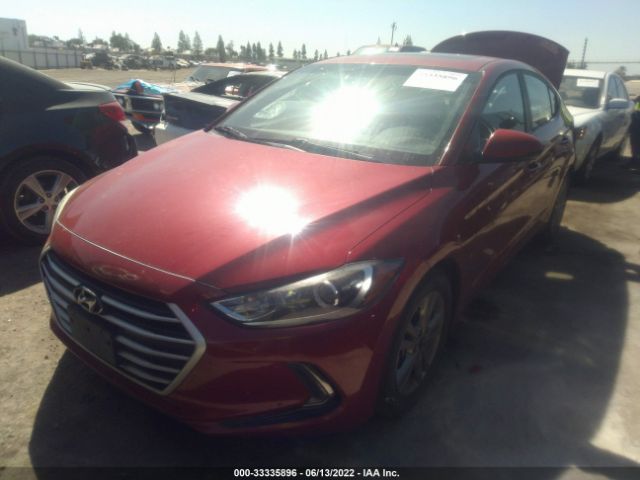 Photo 1 VIN: KMHD84LF7HU397076 - HYUNDAI ELANTRA 