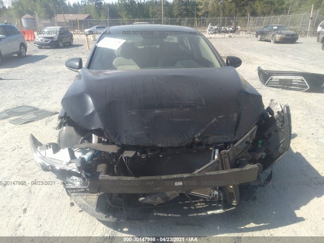 Photo 5 VIN: KMHD84LF8HU237224 - HYUNDAI ELANTRA 