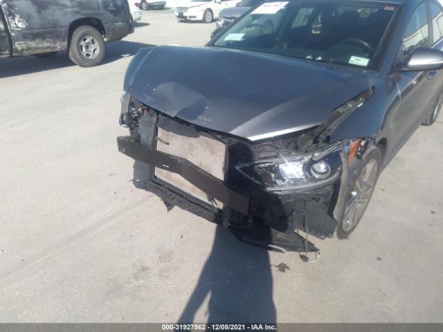 Photo 5 VIN: KMHD84LF8HU263662 - HYUNDAI ELANTRA 