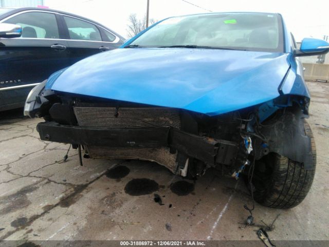 Photo 5 VIN: KMHD84LF8HU263810 - HYUNDAI ELANTRA 