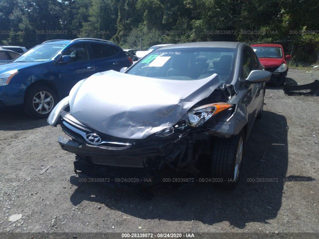 Photo 5 VIN: KMHDH4AE0BU104409 - HYUNDAI ELANTRA 