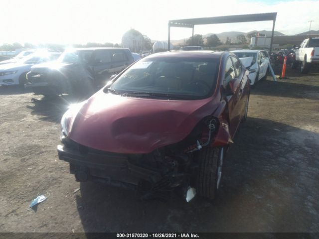 Photo 5 VIN: KMHDH4AE0BU111618 - HYUNDAI ELANTRA 