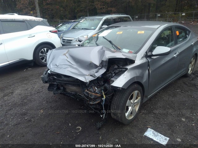 Photo 5 VIN: KMHDH4AE0CU286243 - HYUNDAI ELANTRA 