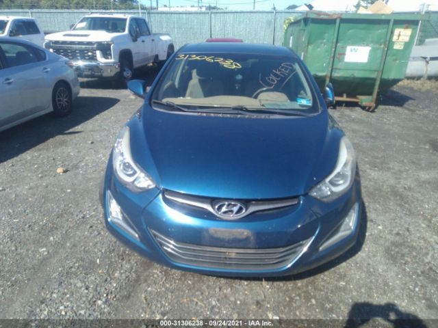 Photo 5 VIN: KMHDH4AE0EU164579 - HYUNDAI ELANTRA 