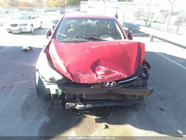 Photo 5 VIN: KMHDH4AE1BU150573 - HYUNDAI ELANTRA 