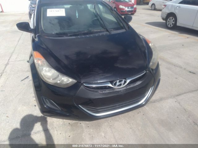 Photo 5 VIN: KMHDH4AE1CU444525 - HYUNDAI ELANTRA 