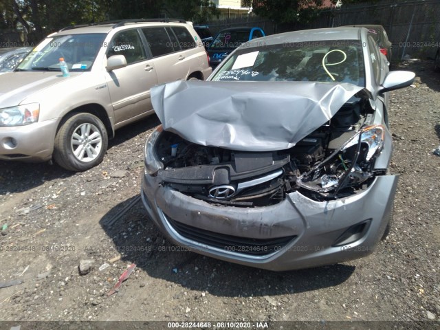 Photo 5 VIN: KMHDH4AE2BU148265 - HYUNDAI ELANTRA 