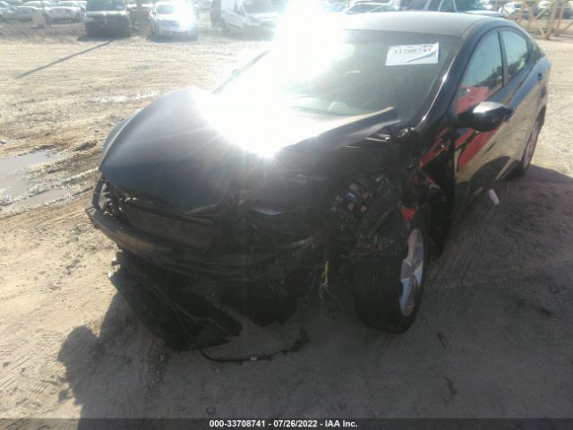 Photo 5 VIN: KMHDH4AE2BU169620 - HYUNDAI ELANTRA 