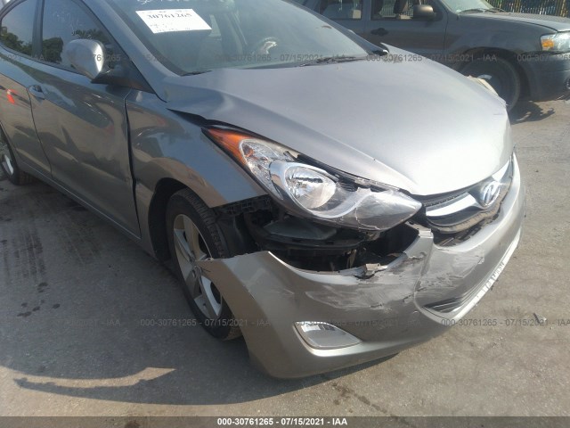 Photo 5 VIN: KMHDH4AE2CU405359 - HYUNDAI ELANTRA 