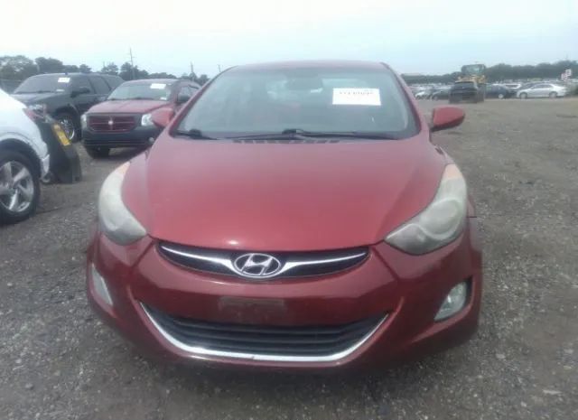 Photo 5 VIN: KMHDH4AE3CU371691 - HYUNDAI ELANTRA 