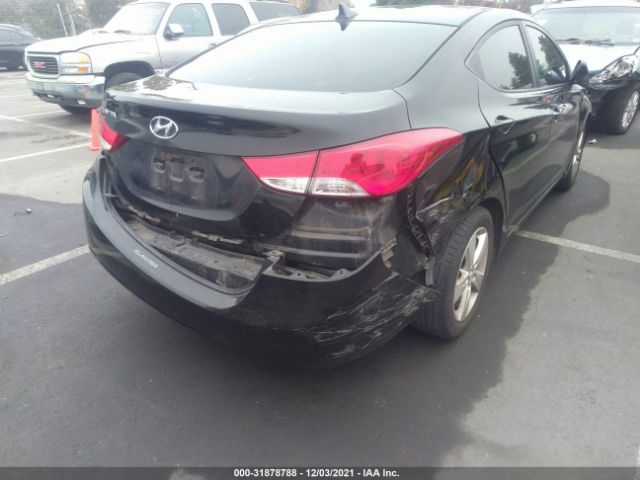 Photo 5 VIN: KMHDH4AE3DU504855 - HYUNDAI ELANTRA 