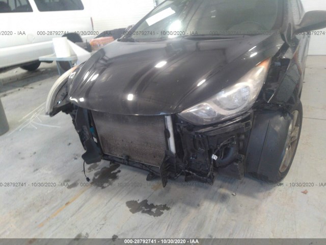 Photo 5 VIN: KMHDH4AE4BU094659 - HYUNDAI ELANTRA 