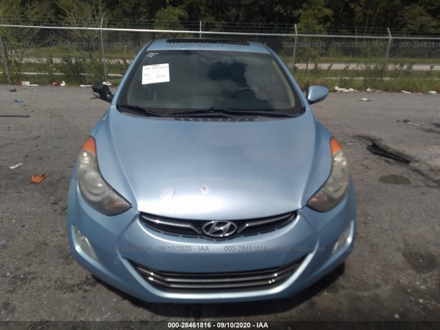 Photo 5 VIN: KMHDH4AE4BU133279 - HYUNDAI ELANTRA 