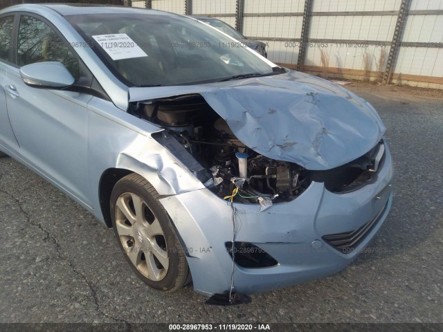 Photo 5 VIN: KMHDH4AE4BU158182 - HYUNDAI ELANTRA 