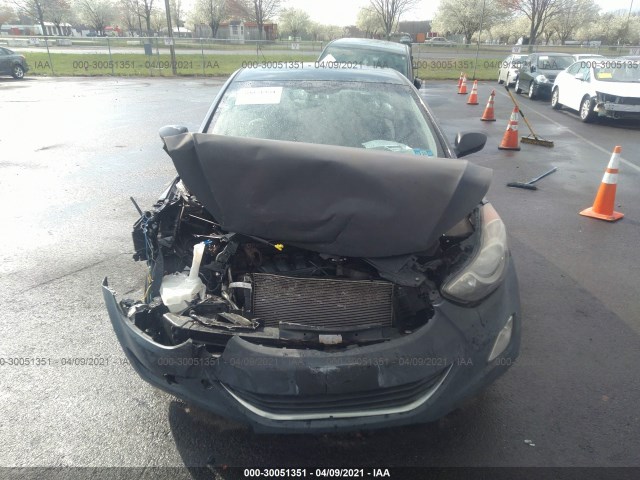 Photo 5 VIN: KMHDH4AE4CU180197 - HYUNDAI ELANTRA 