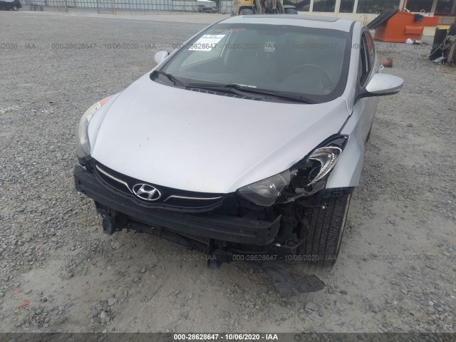 Photo 5 VIN: KMHDH4AE5CU471632 - HYUNDAI ELANTRA 