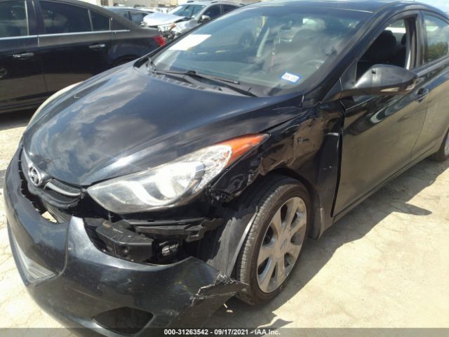 Photo 5 VIN: KMHDH4AE5DU956130 - HYUNDAI ELANTRA 