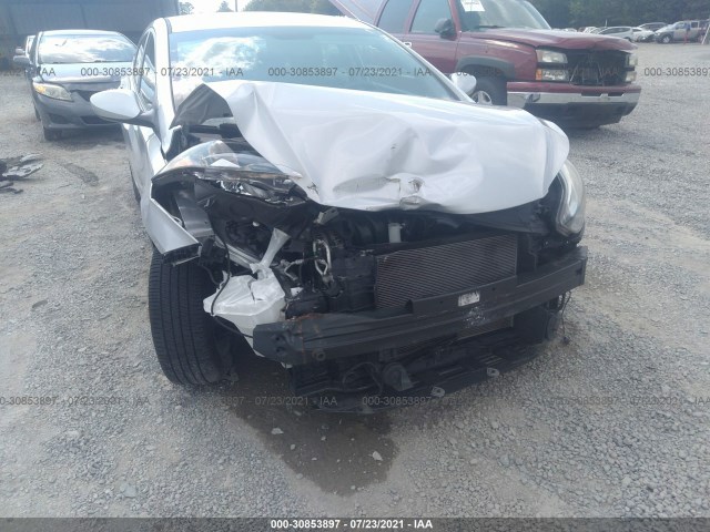 Photo 5 VIN: KMHDH4AE5EU033101 - HYUNDAI ELANTRA 